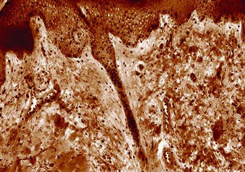 High contrast generated in quantitative phase images of unstained tissues