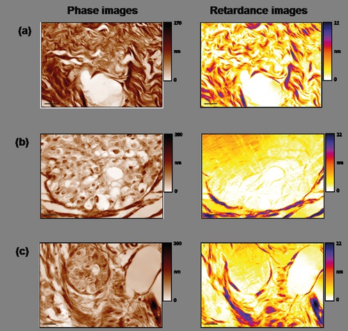 Quantitative Phase Imaging camera from Phasics is used with polarized illumination to measure birefringence in biological sample