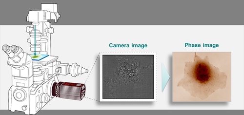 Plug and play Quantitative Phase Imaging camera used in for cytology