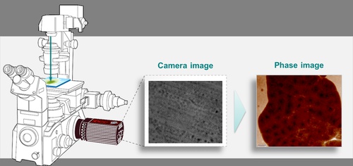 Plug and play Quantitative Phase Imaging camera used for histology